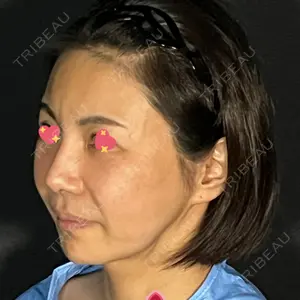 酒井形成外科口コミ