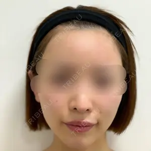 口コミ