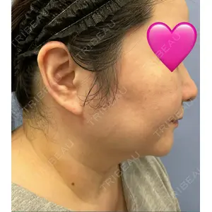 湘南美容クリニック 湘南美容クリニック 秋葉原院口コミ