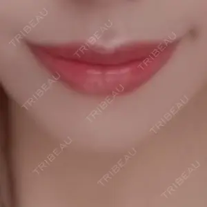 フィラークリニック フィラークリニック 町田院口コミ