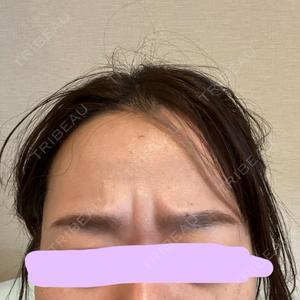 湘南美容クリニック 湘南美容クリニック 大阪梅田本院口コミ