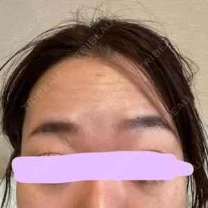 湘南美容クリニック 湘南美容クリニック 大阪梅田本院口コミ
