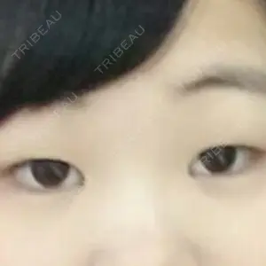 湘南美容クリニック 湘南美容クリニック 池袋東口院口コミ