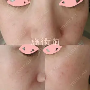 神楽坂美容クリニック タテバ芍薬口コミ
