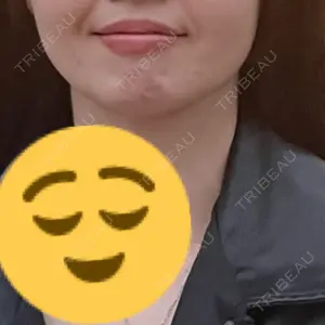 口コミ
