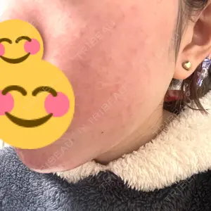 やさしい美容皮膚科・皮フ科 やさしい美容皮膚科・皮フ科　秋葉原院口コミ