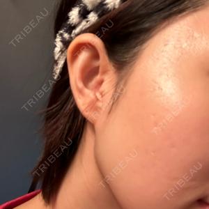 赤羽ここちクリニック口コミ