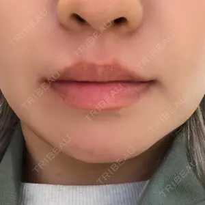 口コミ