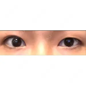 東京イセアクリニック口コミ