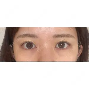 X CLINIC X CLINIC 銀座院口コミ