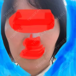 ボンディ美容整形外科（旧リオン整形外科）口コミ