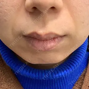 口コミ