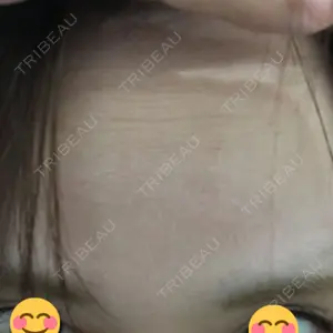 TCB東京中央美容外科 TCB東京中央美容外科 福岡天神院口コミ