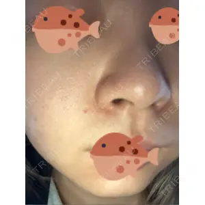口コミ
