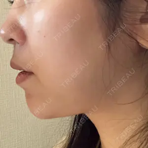 湘南美容クリニック 湘南美容クリニック 秋葉原院口コミ
