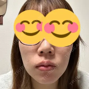 口コミ
