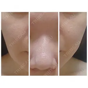A CLINIC（エークリニック） A CLINIC（エークリニック） 福岡院口コミ