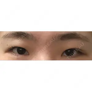 表参道スキンクリニック 表参道スキンクリニック 表参道院口コミ