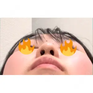 口コミ
