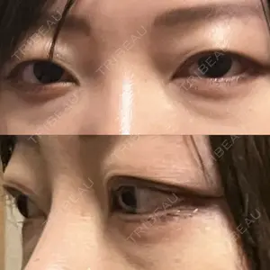 APOLLO BEAUTY CLINIC口コミ