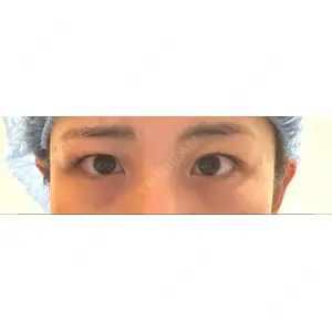 APOLLO BEAUTY CLINIC口コミ