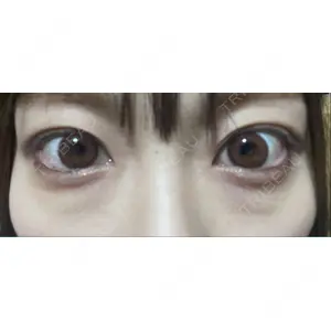 APOLLO BEAUTY CLINIC口コミ