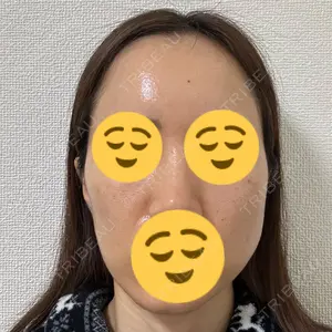 LUNA BEAUTY CLINIC ブリリアスキンクリニック 新宿院口コミ