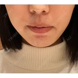 東京美容外科 東京美容外科 福岡院口コミ