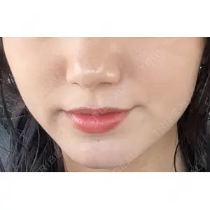 A CLINIC（エークリニック） A CLINIC（エークリニック） 新宿院口コミ