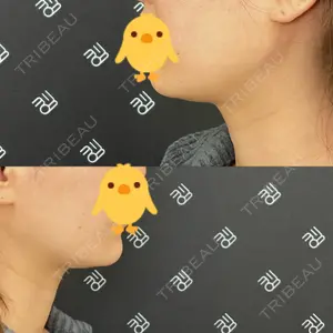 EMMO FACE CLINIC EMMO FACE CLINIC 大阪梅田院口コミ