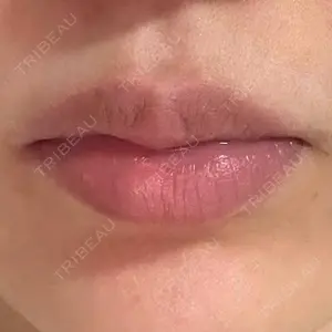 湘南美容クリニック 湘南美容クリニック 金山院口コミ