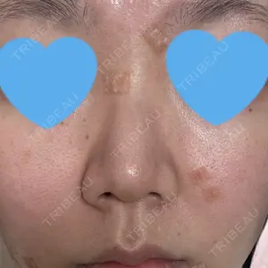 まゆりなclinic 名古屋栄口コミ