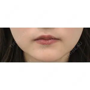 APスキンクリニック銀座口コミ