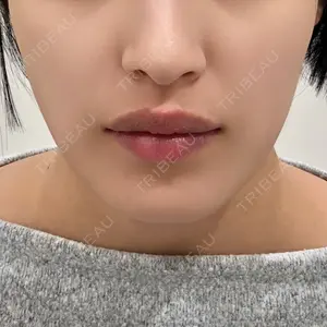 口コミ