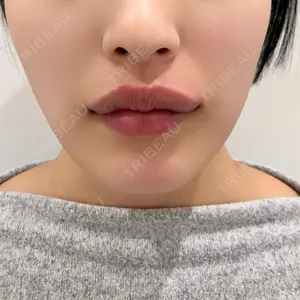 口コミ