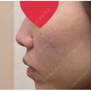 ASTRA BEAUTY CLINICの