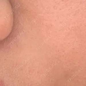 L‘amour clinic Tokyo【ラムールクリニック東京】口コミ
