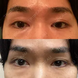 東京イセアクリニック口コミ