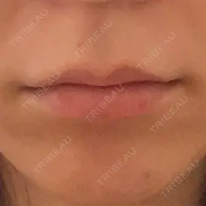 フィラークリニック フィラークリニック 町田院口コミ