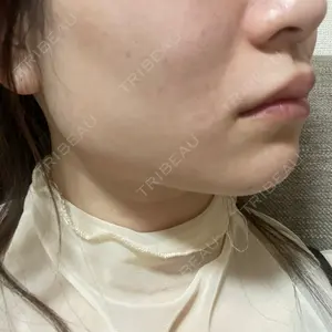 お茶の水美容形成クリニック お茶の水美容形成クリニック口コミ