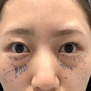 X CLINIC X CLINIC 銀座院口コミ