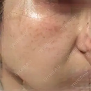 神楽坂美容クリニック タテバ芍薬口コミ
