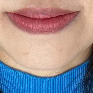 口コミ