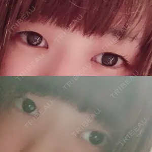 湘南美容クリニック 湘南美容クリニック 新宿本院口コミ