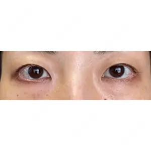 東京イセアクリニック口コミ