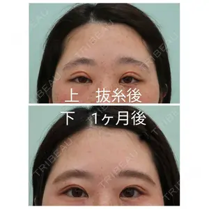 口コミ