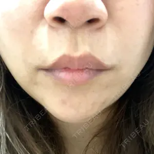 ノーチェビューティクリニック口コミ
