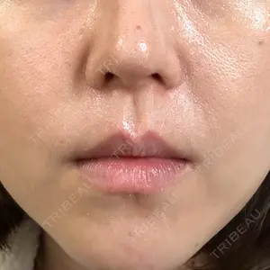 LUNA BEAUTY CLINIC ブリリアスキンクリニック 新宿院口コミ