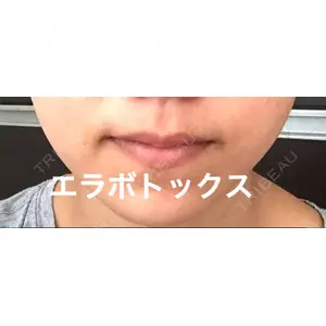 湘南美容クリニック 湘南美容クリニック 新宿本院口コミ