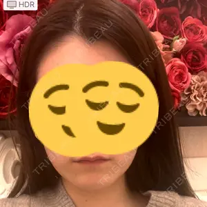 A CLINIC（エークリニック） A CLINIC（エークリニック） 福岡院口コミ